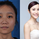 Image for article titled Intense Photos of Plastic Surgery Tranformations Going Viral in China